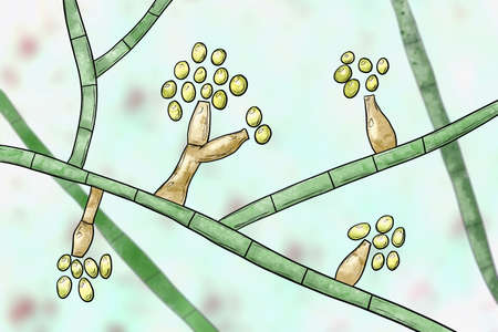 Mould fungi Madurella, scientific illustration. The microscopic fungus that causes black-grain mycetoma, or maduromycosis, an infection of human extremities and nervous system found in tropical areasの写真素材