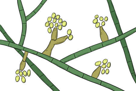 Mould fungi Madurella, scientific illustration. The microscopic fungus that causes black-grain...