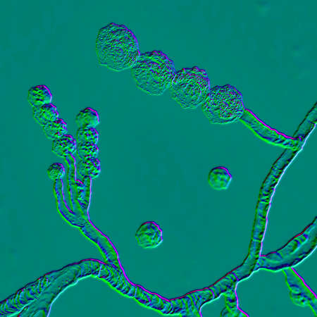 Microscopic fungi Scopulariopsis brevicaulis, 3D illustration. Fungus that infects nails, causes subcutaneous and invasive infections, endocarditis, sinusitis, disseminated infectionの写真素材