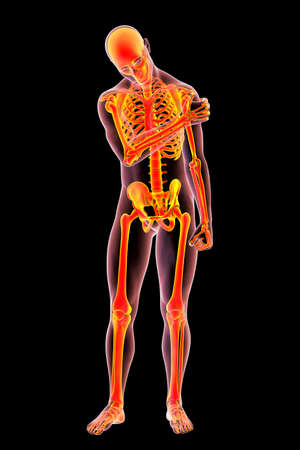 Shoulder pain, conceptual 3D illustration showing human male body with highlighted skeleton having painful shoulderの写真素材