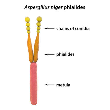 Phialide of Aspergillus niger fungus, black mold that produce aflatoxins and cause pulmonary...