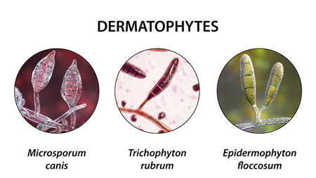 Dermatophyte fungi, 3D illustration. Microsporum, Trichophyton, and Epidermophyton, the causative...