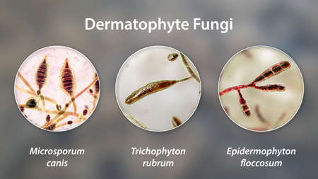 Dermatophyte fungi, 3D illustration. Microsporum, Trichophyton, and Epidermophyton, the causative...