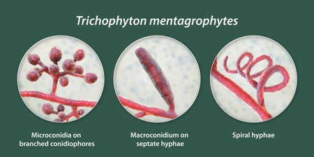 Fungi Trichophyton mentagrophytes, 3D illustration showing branched conidiophores bearing spherical...