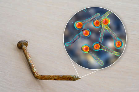 Tetanus. Bacteria Clostridium tetani and a rusty metal nail as a common cause of transmission of tetanus bacteria by contaminated foot wound from nails and other dirty objects, 3D illustrationの写真素材