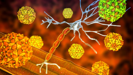 Polio viruses affecting motor neurons, conceptual 3D illustration. Mechanism of polio disease