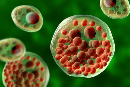Rhinosporidium seeberi parasite, the causative agent of rhinosporidiosis, disease with formation of...