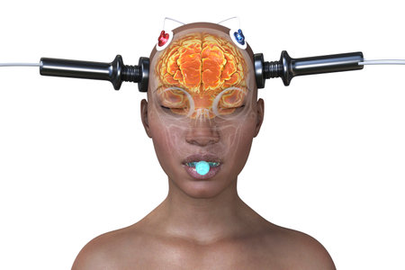 Electroconvulsive therapy, ECT, a treatment used for severe mental illnesses involving the use of...