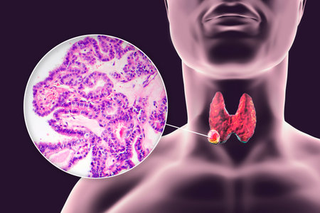A 3D scientific illustration showcasing a human body with transparent skin, revealing a tumor in his...