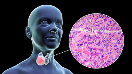 A 3D scientific illustration showcasing a female body with transparent skin, revealing a tumor in...