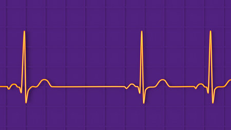 A detailed 3D illustration of an Electrocardiogram ECG displaying sinus arrhythmia, a condition...