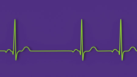 A detailed 3D illustration of an Electrocardiogram ECG displaying sinus arrhythmia, a condition characterized by irregular heart rhythms originating from the sinus node.の写真素材