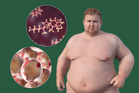 A 3D medical illustration featuring an overweight man with a close-up view of adipocytes and cholesterol molecules, highlighting the relationship between obesity and cholesterol metabolism.の写真素材