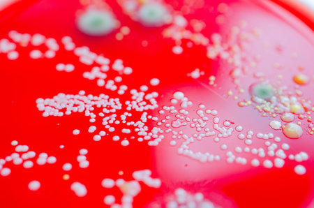 Bacterial and mold fungi colonies grown from indoor air on blood sheep agar, photograph showing microbial diversity and air contamination.の写真素材