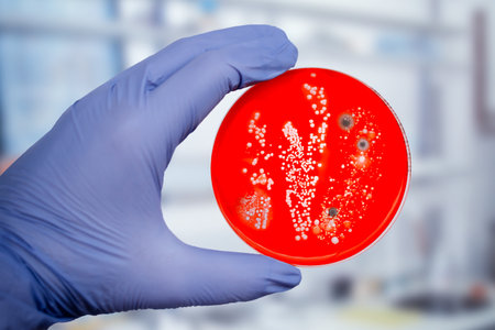 Bacterial and mold fungi colonies grown from indoor air on blood sheep agar, photograph showcasing microbial diversity and air contamination.の写真素材