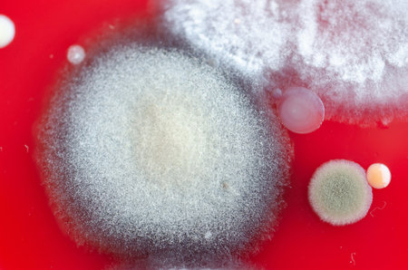 Bacterial and mold fungi colonies grown from indoor air on blood sheep agar, photograph showing microbial diversity and air contamination.の写真素材