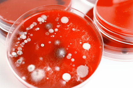 Bacterial and mold fungi colonies grown from indoor air on blood sheep agar, photograph showing...