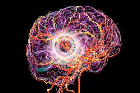 3D illustration of a saccular (berry) aneurysm on the brain middle cerebral artery, highlighting vascular pathology and stroke risk.の写真素材