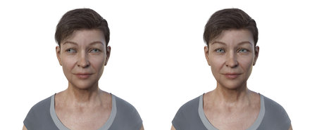A woman with esotropia and the same healthy person. 3D illustration showing inward eye misalignment.の写真素材