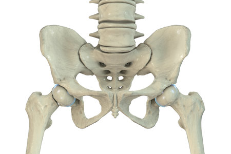Subcapital femur fracture, 3D illustration showing a break just below the femoral head, near the hip joint.の写真素材
