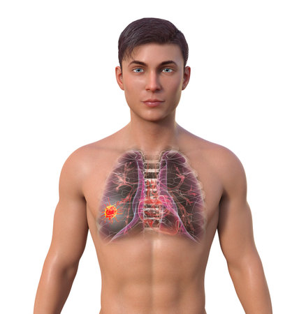 A 3D photorealistic illustration of a man with transparent skin, revealing the presence of lung cancer.の写真素材