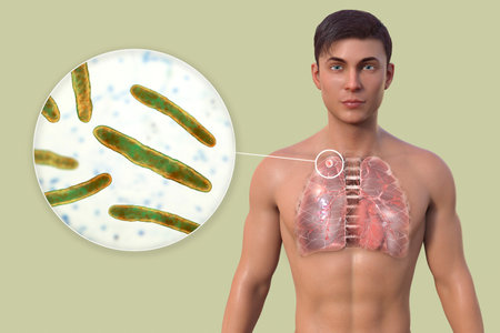 A man with transparent skin revealing the lungs affected by secondary tuberculosis and close-up view of Mycobacterium tuberculosis bacteria, 3D illustration.の写真素材