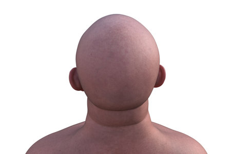 3D illustration of a man's hairless head from back top view, emphasizing skull shape, neck, and anatomical details.の写真素材