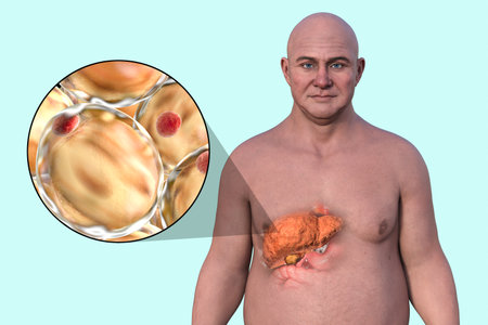 3D illustration of a Caucasian man with transparent skin, revealing a fatty liver, highlighting liver anatomy and fat accumulation, alongside with close-up view of fat cells.の写真素材