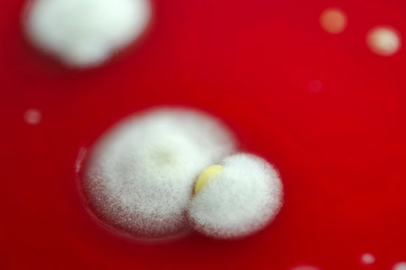Mold fungi colonies grown from indoor air on blood sheep agar, photograph showcasing microbial diversity and air contamination.の写真素材
