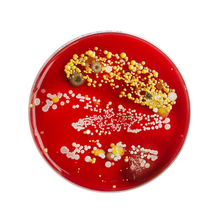Bacterial and mold fungi colonies grown from hands skin surface on blood sheep agar, photograph showcasing microbial diversity and skin contamination.の写真素材