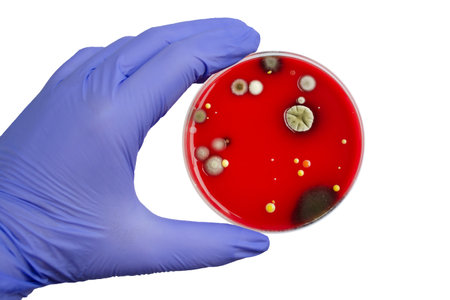 Bacterial and mold fungi colonies grown from indoor air on blood sheep agar, photograph showcasing microbial diversity and air contamination.の写真素材