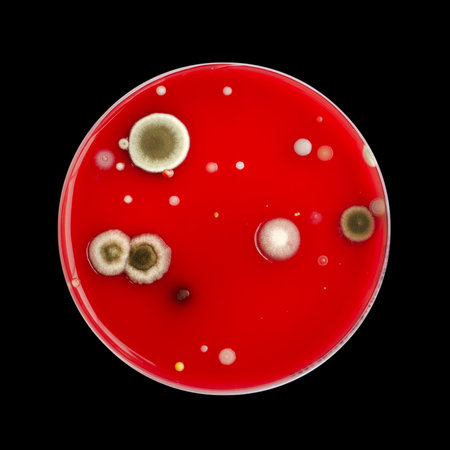Bacterial and mold fungi colonies grown from indoor air on blood sheep agar, photograph showcasing microbial diversity and air contamination.の写真素材