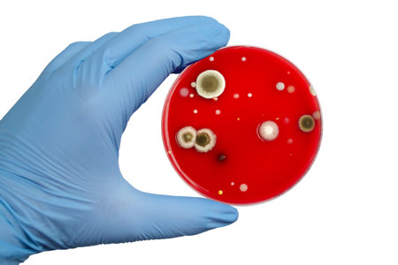 Bacterial and mold fungi colonies grown from indoor air on blood sheep agar, photograph showcasing microbial diversity and air contamination.の写真素材