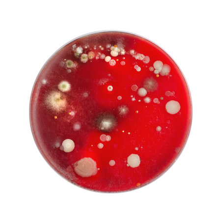 Bacterial and mold fungi colonies grown from indoor air on blood sheep agar, photograph showcasing microbial diversity and air contamination.の写真素材