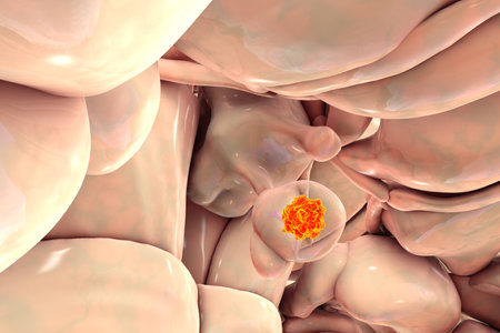 A pituitary gland tumor, 3D medical illustration highlighting its location and impact on nearby structures.の写真素材