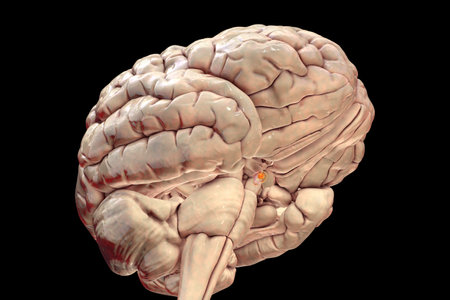 A pituitary gland tumor, 3D medical illustration highlighting its location and impact on nearby structures.の写真素材