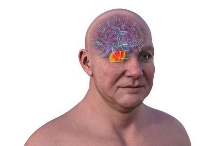 3D illustration of the human brain with the pons highlighted in red, responsible for regulating breathing, sleep, and communication between brain regions.の写真素材