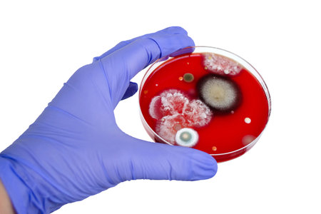 Mold fungi colonies grown from indoor air on blood sheep agar, photograph showcasing microbial diversity and air contamination.の写真素材