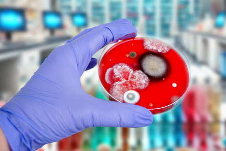 Mold fungi colonies grown from indoor air on blood sheep agar, photograph showcasing microbial diversity and air contamination.の写真素材