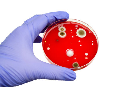 Bacterial and mold fungi colonies grown from indoor air on blood sheep agar, photograph showcasing microbial diversity and air contamination.の写真素材