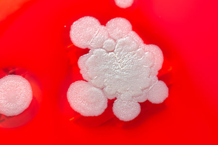 Mold fungi colonies grown from indoor air on blood sheep agar, photograph showcasing microbial diversity and air contamination.の写真素材