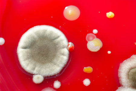 Mold fungi colonies grown from indoor air on blood sheep agar, photograph showcasing microbial diversity and air contamination.の写真素材