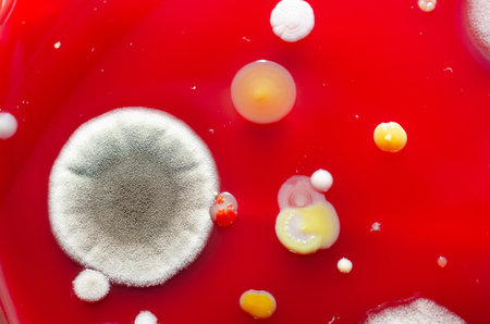 Bacterial and mold fungi colonies grown from indoor air on blood sheep agar, photograph showcasing microbial diversity and air contamination.の写真素材
