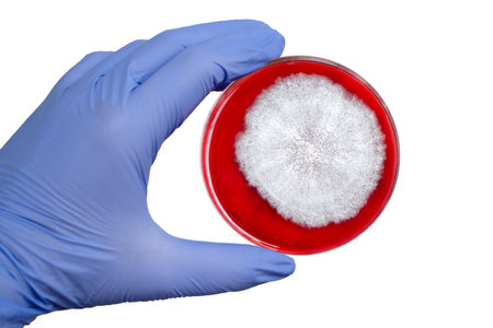 Mucor fungi colonies on potato dextrose agar, photograph showing fast-growing, fluffy, white to gray...