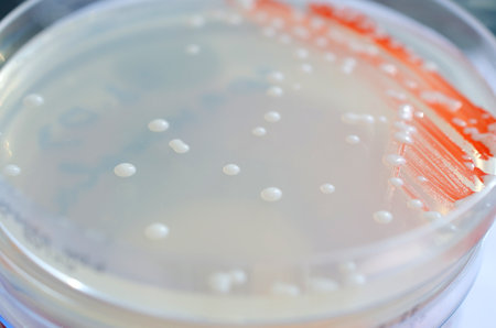 Isolated bacterial colonies on potato dextrose agar, photograph showing white smooth, round colonies with opaque centers.の写真素材