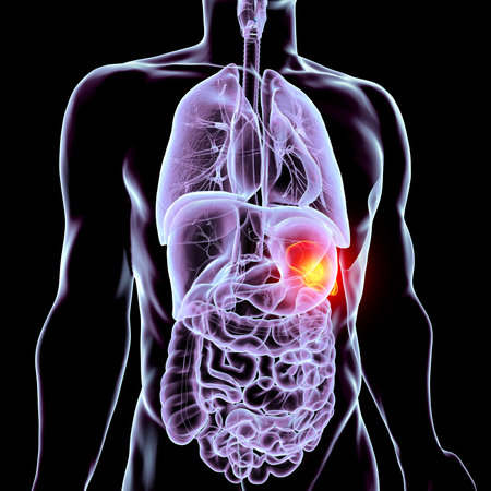 Spleen cancer, 3D illustration showing malignant growth in the spleen, affecting blood filtration and immune function.の写真素材