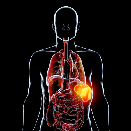 Splenomegaly, 3D illustration showing enlarged spleen. Occurs in infections, liver cirrhosis, leukemia, lymphoma, malaria, and autoimmune diseases.の写真素材