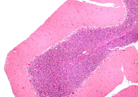 Human cerebellar cortex, photomicrograph showing Purkinje cells, granular cells, and molecular layer involved in motor coordination and balance.の写真素材