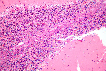 Human cerebellar cortex, photomicrograph showing Purkinje cells, granular cells, and molecular layer involved in motor coordination and balance.の写真素材