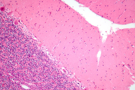 Human cerebellar cortex, photomicrograph showing Purkinje cells, granular cells, and molecular layer involved in motor coordination and balance.の写真素材